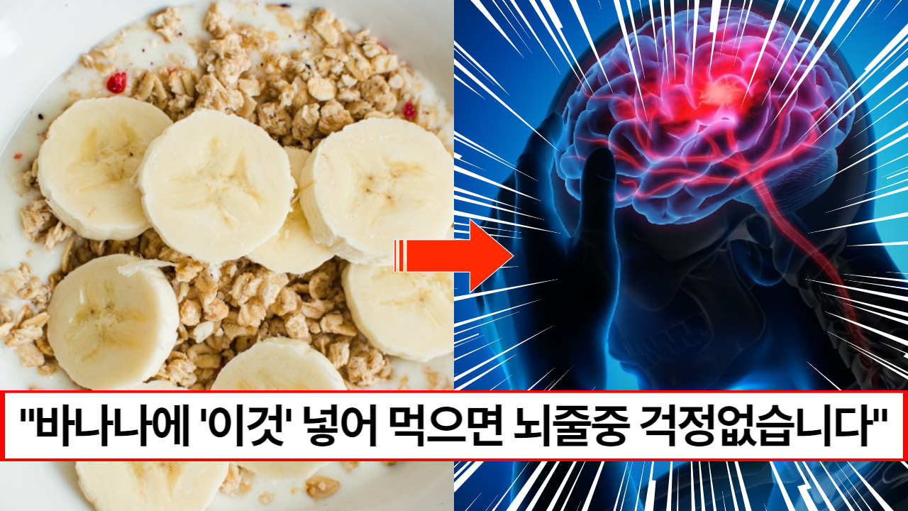 "바나나와 함께 드세요" 같이 먹게 되면 병든 혈관이 튼튼해지고 뇌줄중 예방하는 보약이 됩니다